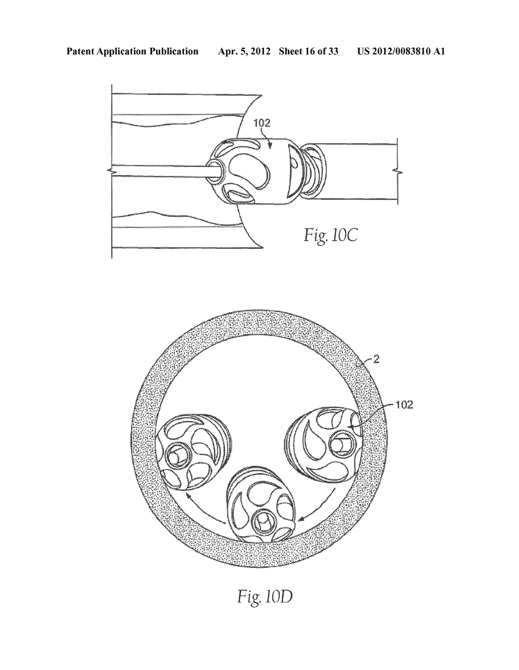 ATHERECTOMY DEVICES AND METHODS - diagram, schematic, and image 17