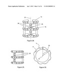 External scaffolds for expanding strictures in tubular organs and their     use diagram and image