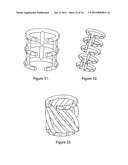 External scaffolds for expanding strictures in tubular organs and their     use diagram and image