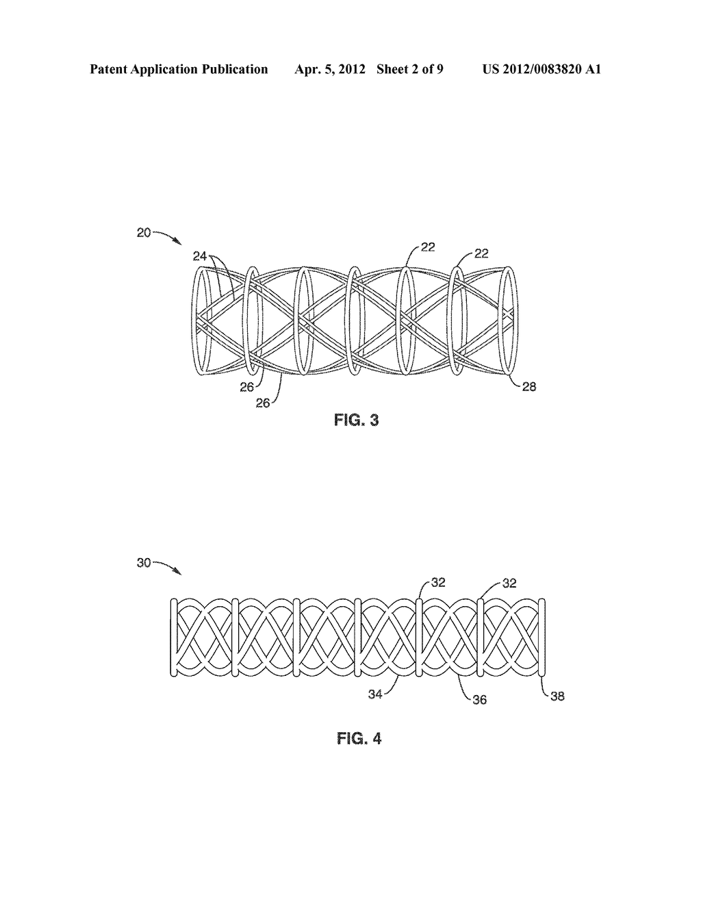 EXPANDABLE DISTENSION DEVICE FOR HOLLOW ORGAN GROWTH - diagram, schematic, and image 03