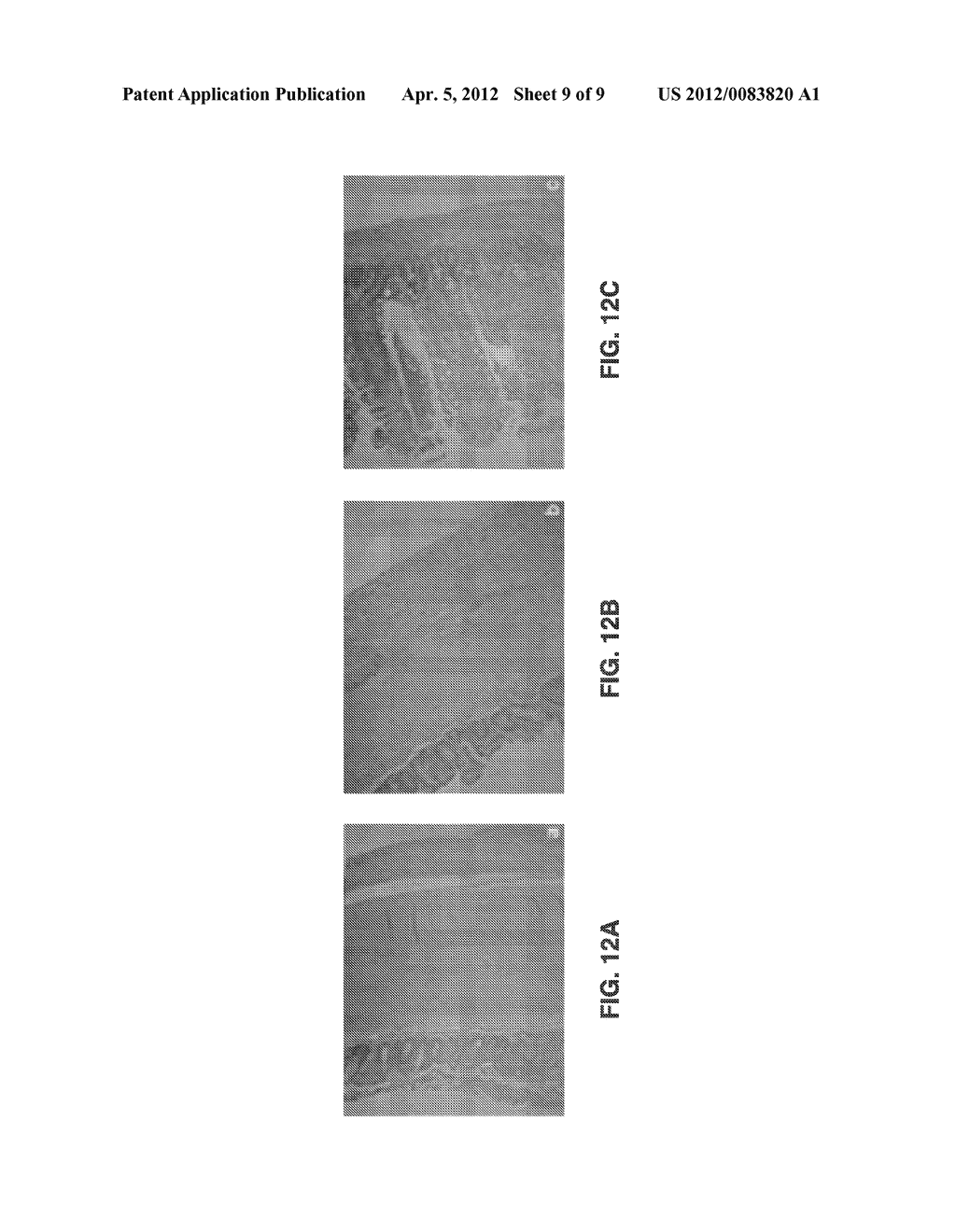 EXPANDABLE DISTENSION DEVICE FOR HOLLOW ORGAN GROWTH - diagram, schematic, and image 10