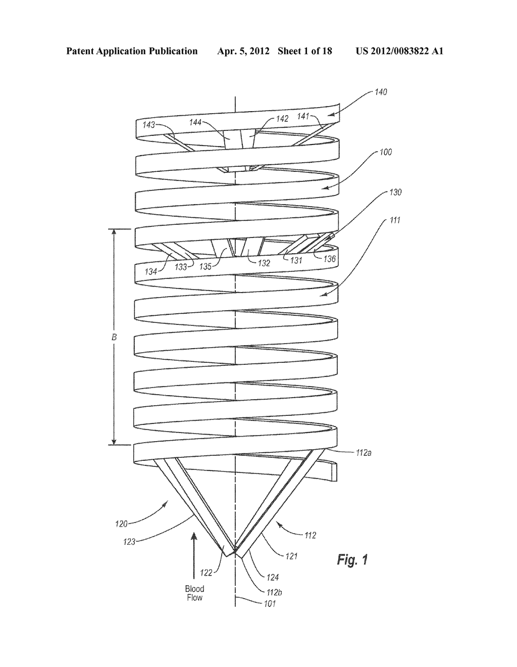METHODS AND APPARATUS FOR FILTERING A BODY LUMEN - diagram, schematic, and image 02