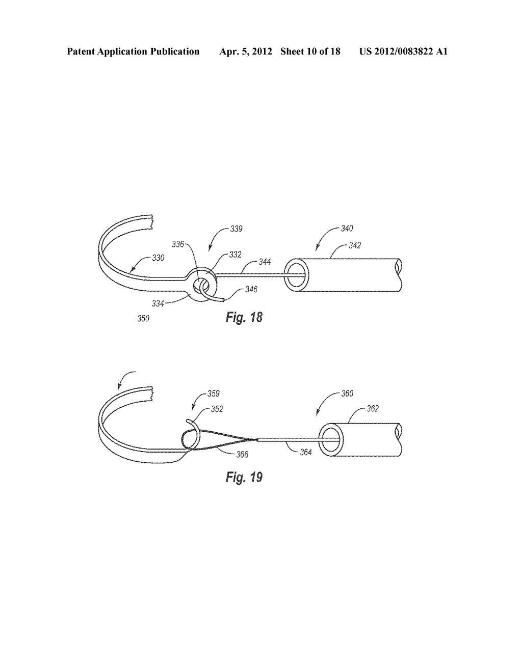 METHODS AND APPARATUS FOR FILTERING A BODY LUMEN - diagram, schematic, and image 11