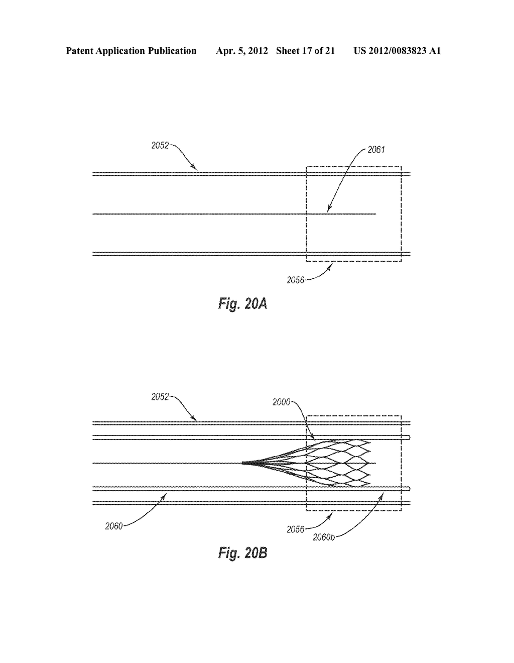 APPARATUS FOR FILTERING A BODY LUMEN - diagram, schematic, and image 18