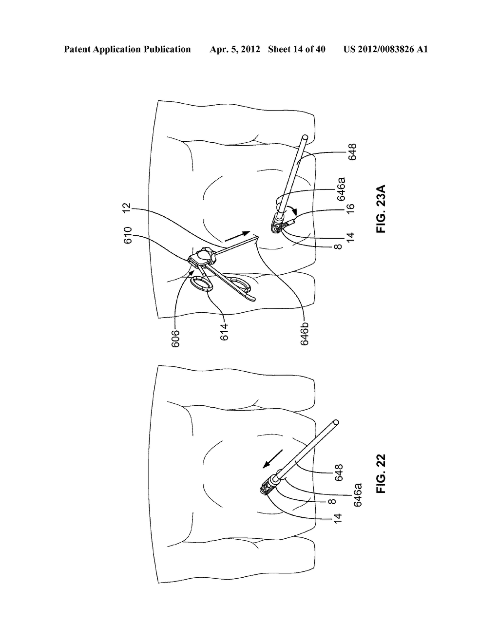 SURGICAL DEVICE AND METHODS - diagram, schematic, and image 15