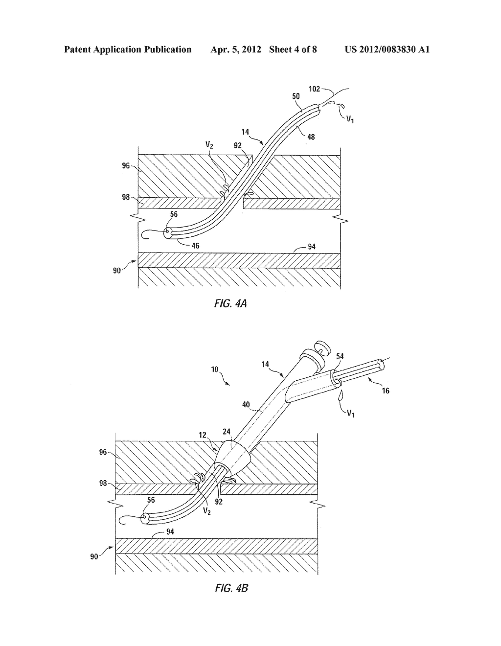 APPARATUS AND METHODS FOR SEALING VASCULAR PUNCTURES - diagram, schematic, and image 05
