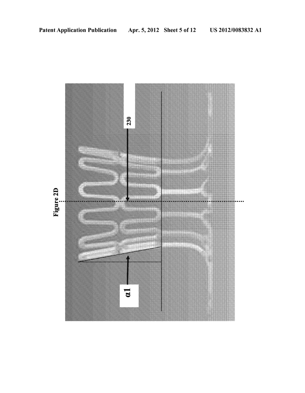 CLOSURE DEVICE AND METHODS AND SYSTEMS FOR USING SAME - diagram, schematic, and image 06