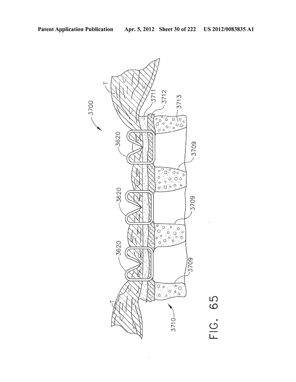 STAPLE CARTRIDGE COMPRISING A TISSUE THICKNESS COMPENSATOR - diagram, schematic, and image 31