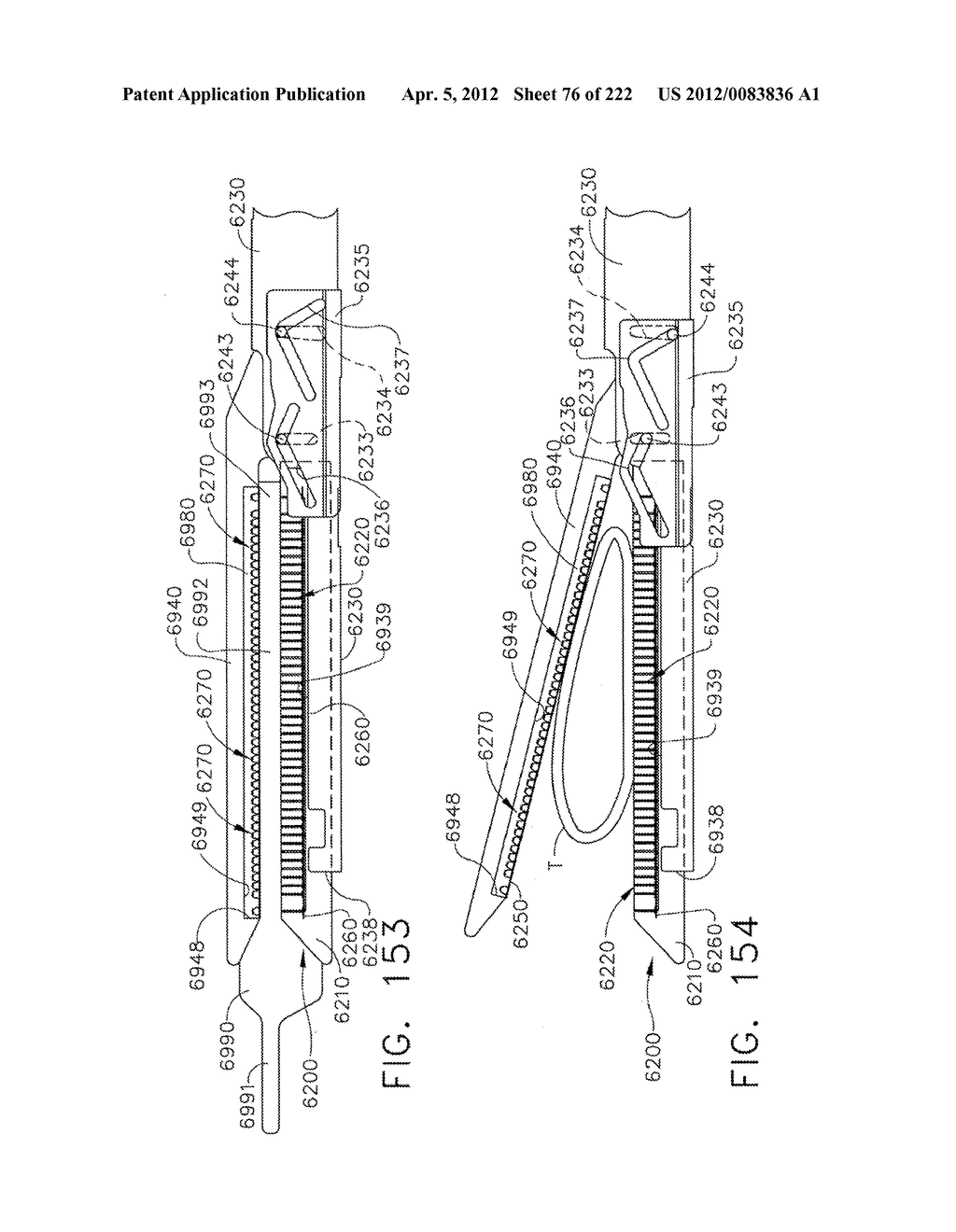 STAPLE CARTRIDGE COMPRISING AN ADJUSTABLE DISTAL PORTION - diagram, schematic, and image 77