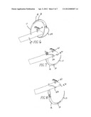 Tissue Fixator diagram and image