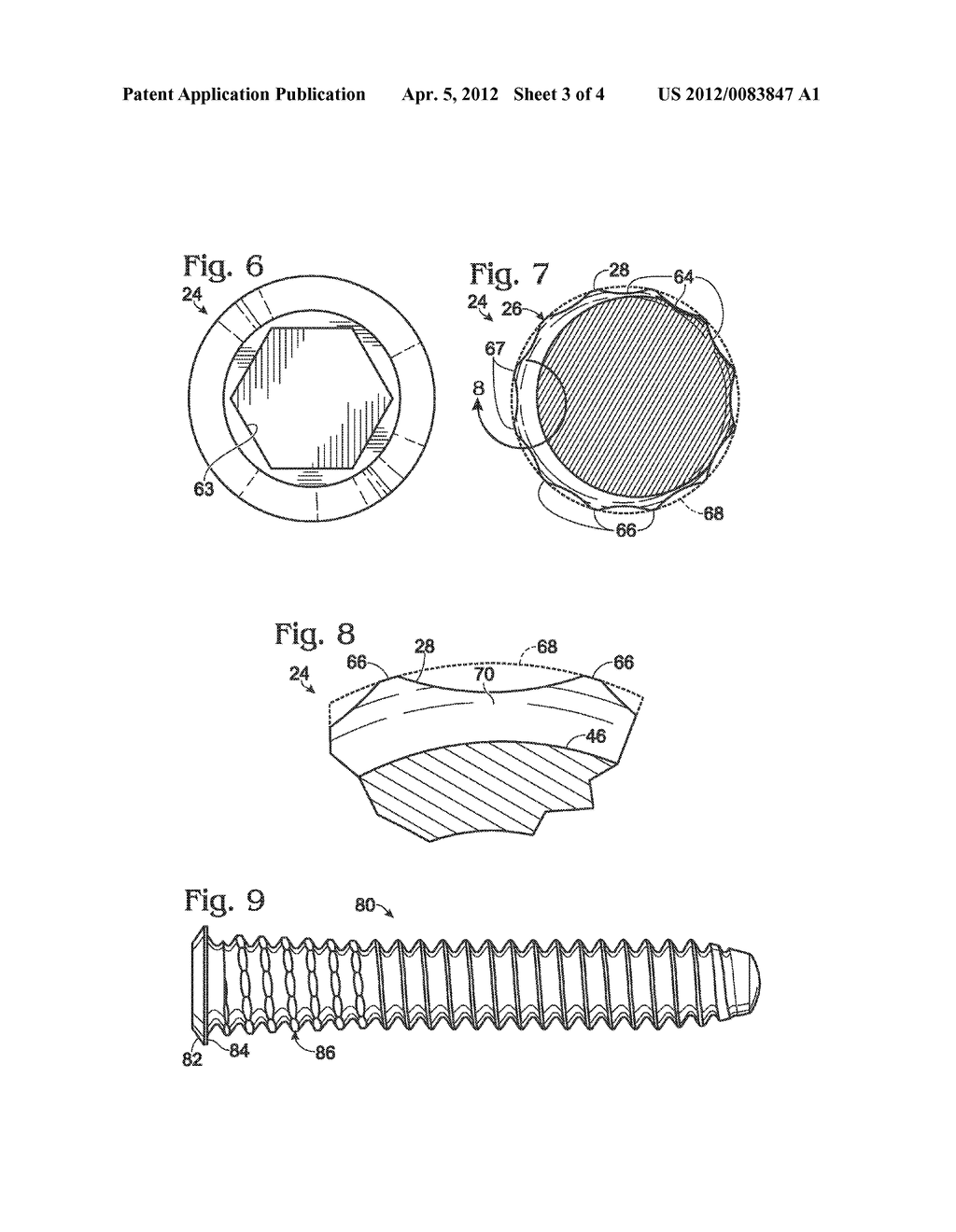 FASTENER WITH SERRATED THREAD FOR ATTACHMENT TO A BONE PLATE AT A     SELECTABLE ANGLE - diagram, schematic, and image 04