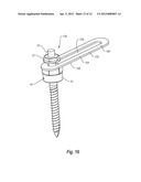 METHOD FOR POLYAXIAL SCREW SYSTEM diagram and image