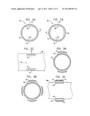 GI AND PANCREATIC DEVICE FOR TREATING OBESITY AND DIABETES diagram and image