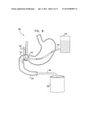 GI AND PANCREATIC DEVICE FOR TREATING OBESITY AND DIABETES diagram and image