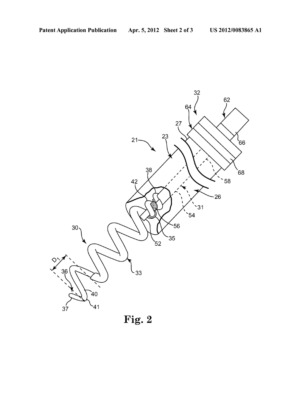 MEDICAL DEVICE LEAD INCLUDING A ROTATABLE COMPOSITE CONDUCTOR - diagram, schematic, and image 03