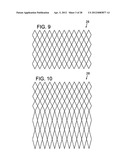 EXPANDABLE SHEATH FOR INTRODUCING AN ENDOVASCULAR DELIVERY DEVICE INTO A     BODY diagram and image