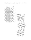 EXPANDABLE SHEATH FOR INTRODUCING AN ENDOVASCULAR DELIVERY DEVICE INTO A     BODY diagram and image