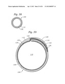 EXPANDABLE SHEATH FOR INTRODUCING AN ENDOVASCULAR DELIVERY DEVICE INTO A     BODY diagram and image