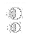 EXPANDABLE SHEATH FOR INTRODUCING AN ENDOVASCULAR DELIVERY DEVICE INTO A     BODY diagram and image