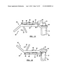 Modular Radial Head Prostheses diagram and image