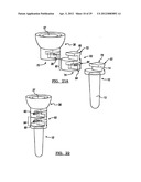 Modular Radial Head Prostheses diagram and image