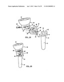 Modular Radial Head Prostheses diagram and image