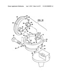 Modular Radial Head Prostheses diagram and image