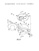 Modular Radial Head Prostheses diagram and image