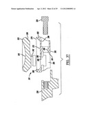 Modular Radial Head Prostheses diagram and image