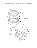 Modular Radial Head Prostheses diagram and image