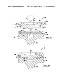 Modular Radial Head Prostheses diagram and image