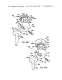 Modular Radial Head Prostheses diagram and image