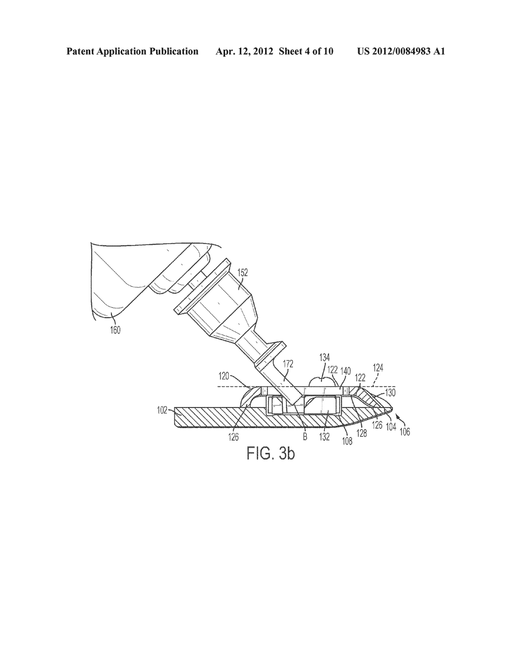 DRIVE SYSTEM FOR ROTARY DRIVEN HAIR CLIPPERS - diagram, schematic, and image 05