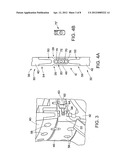 EXPANDING TUBE SEPARATION DEVICE diagram and image