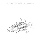 RELEASABLE STEP LOCKING SYSTEM diagram and image