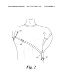 METHOD AND SYSTEM FOR AN OVER THE SHOULDER HOLSTER BELT diagram and image