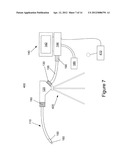 Endoscope and Angiograph System with Options for Advantages in     Signal-to-Noise and Disposability diagram and image