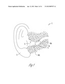 STANDARD FIT HEARING ASSISTANCE DEVICE WITH REMOVABLE SLEEVE diagram and image