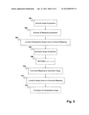 DEVICE AND METHOD FOR CEREBRAL LOCATION ASSISTANCE diagram and image