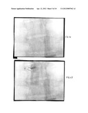 Imaging System and Method for Surgical and Interventional Medical     Procedures diagram and image