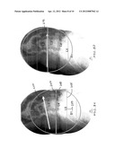 Imaging System and Method for Surgical and Interventional Medical     Procedures diagram and image