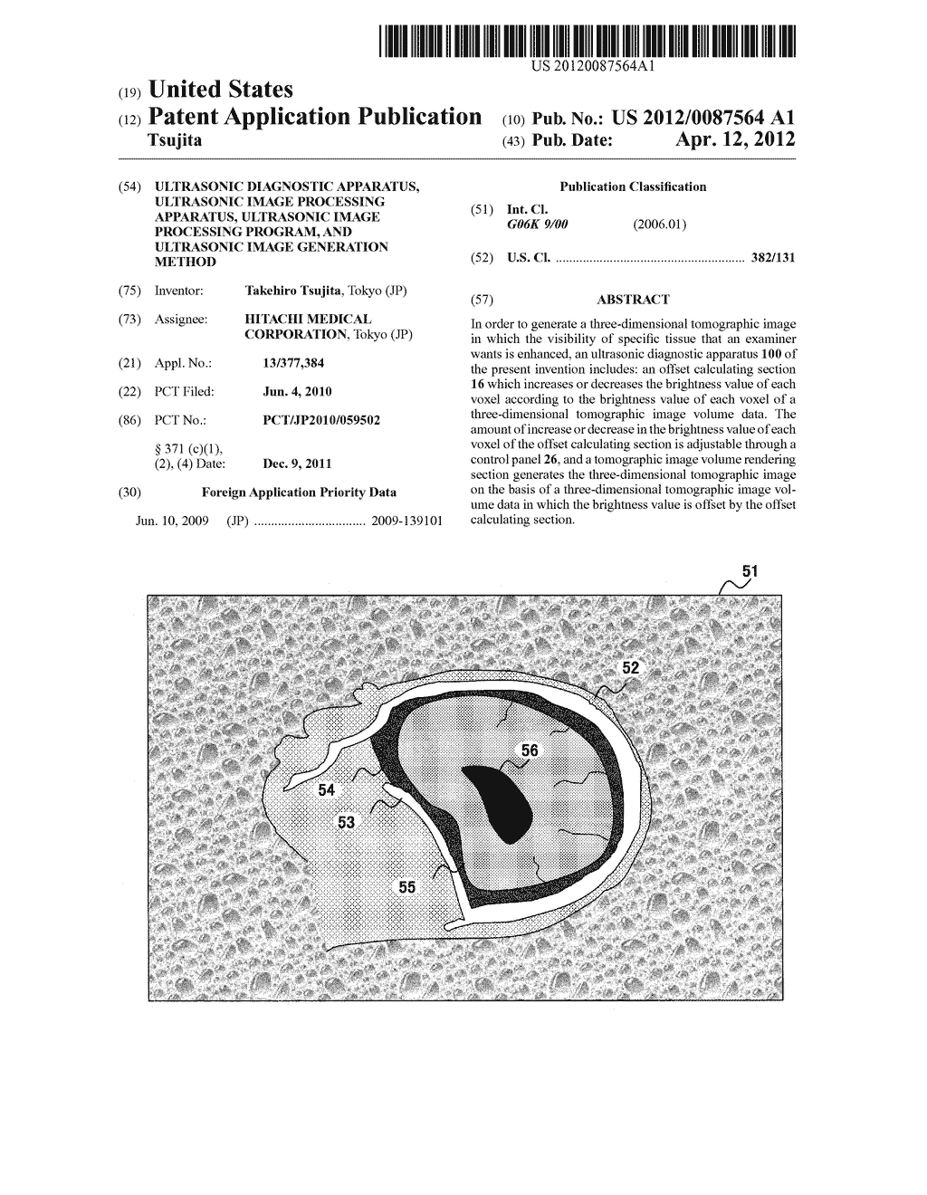 ULTRASONIC DIAGNOSTIC APPARATUS, ULTRASONIC IMAGE PROCESSING APPARATUS,     ULTRASONIC IMAGE PROCESSING PROGRAM, AND ULTRASONIC IMAGE GENERATION     METHOD - diagram, schematic, and image 01