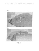 VECTOR FOR TREATING ALZHEIMER S DISEASE diagram and image