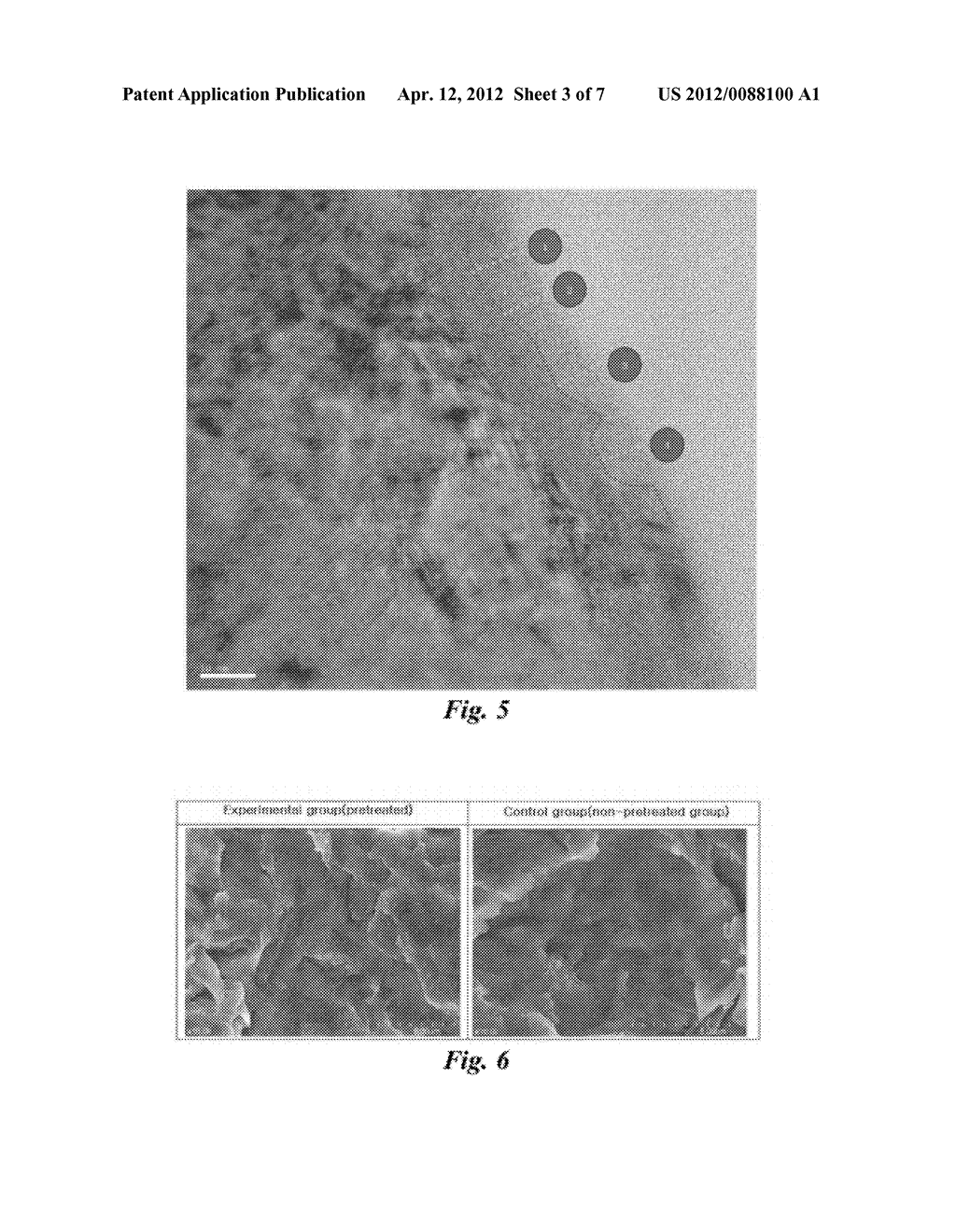 IMPLANTS COATED WITH LOW CRYSTALLINE HYDROXYAPATITE IN FORM OF A NETWORK     OR AN ISLAND AND A METHOD FOR COATING THE SAME - diagram, schematic, and image 04