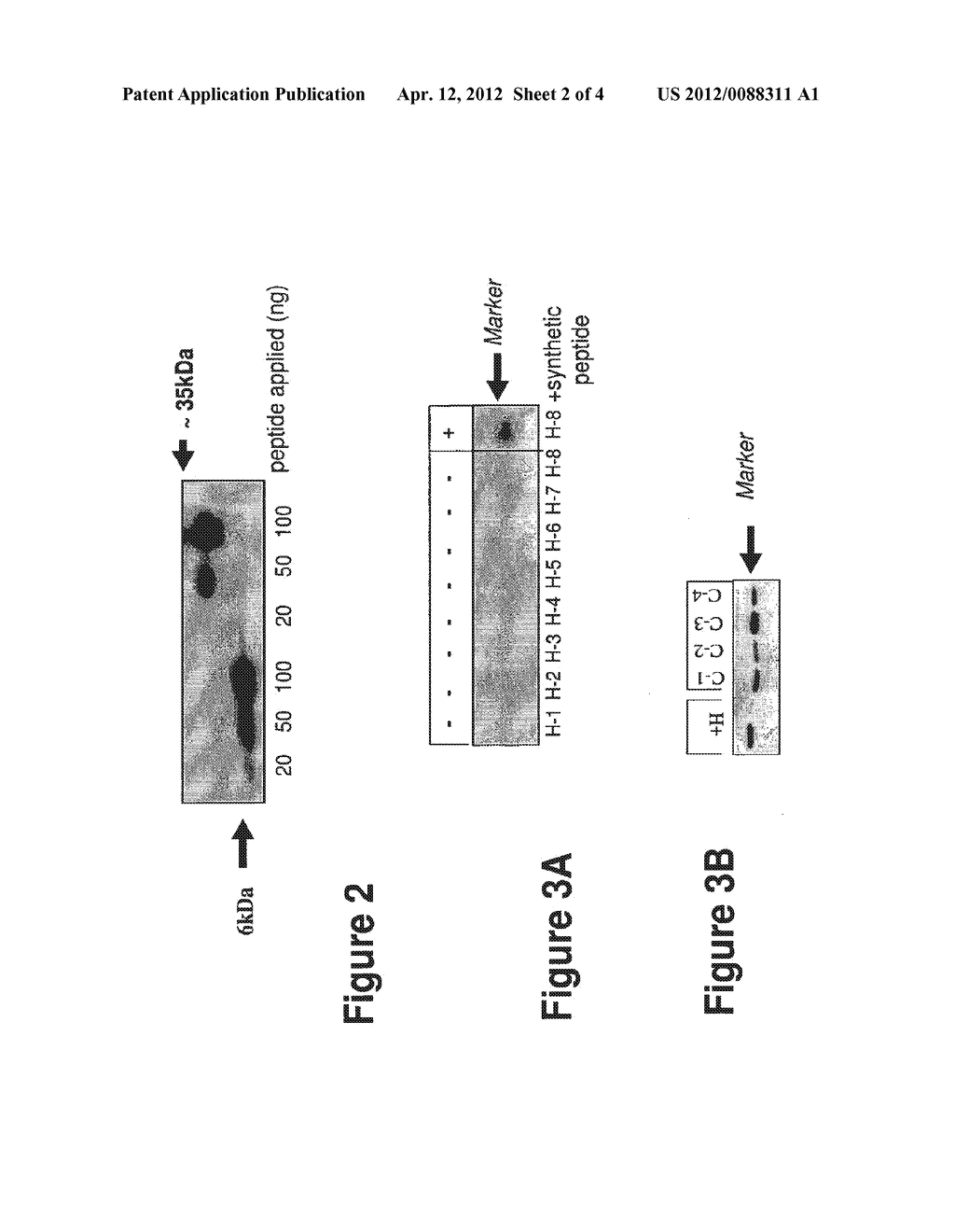 Immuno-Detection of a Cancerous State in a Subject - diagram, schematic, and image 03