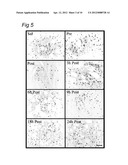 USE OF C1 INHIBITOR FOR THE PREVENTION OF ISCHEMIA-REPERFUSION INJURY diagram and image