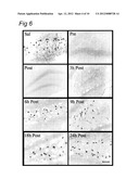 USE OF C1 INHIBITOR FOR THE PREVENTION OF ISCHEMIA-REPERFUSION INJURY diagram and image