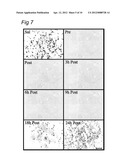 USE OF C1 INHIBITOR FOR THE PREVENTION OF ISCHEMIA-REPERFUSION INJURY diagram and image