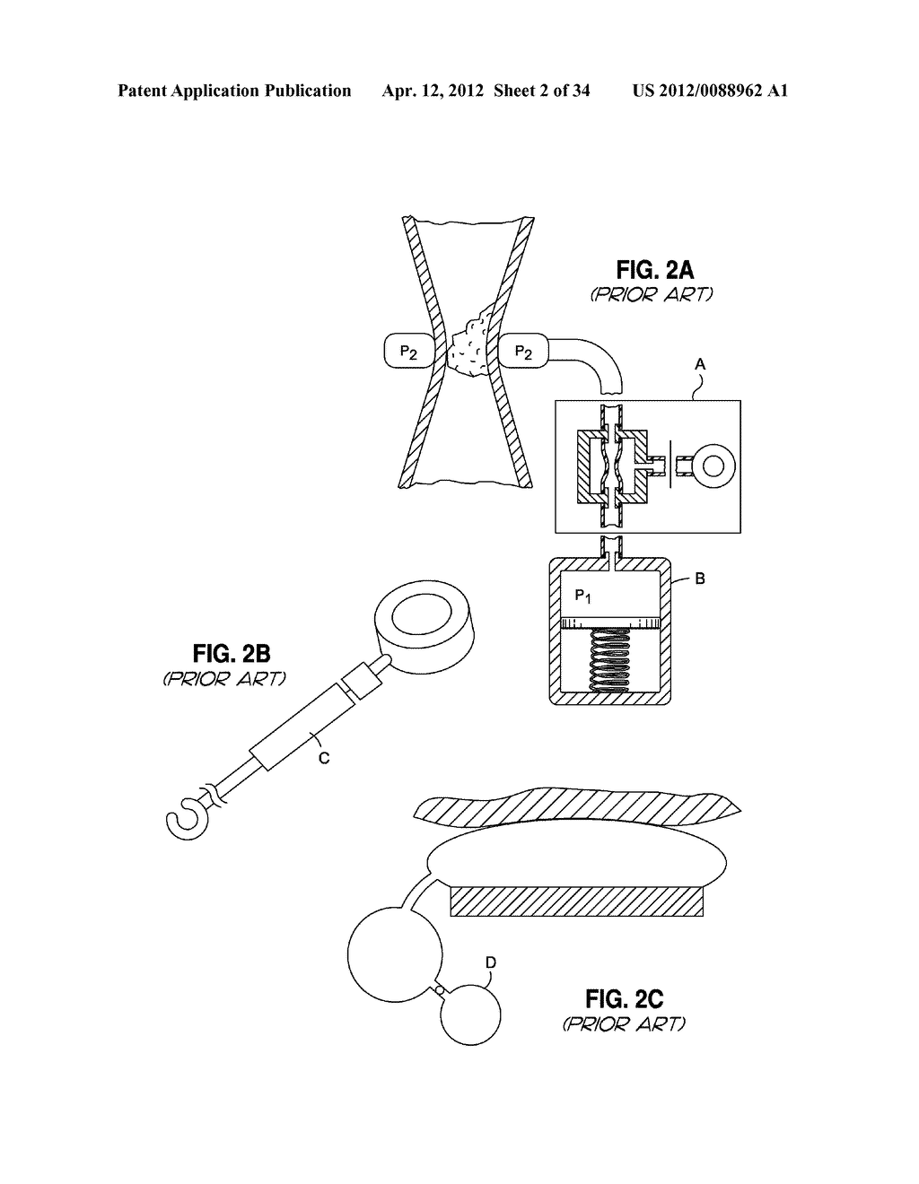 SELF-ADJUSTING GASTRIC BAND - diagram, schematic, and image 03