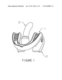 ROTICAM: An Orotracheal Guide with Camera diagram and image